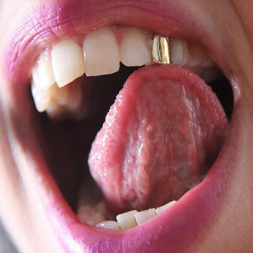 قطعتان من دعامة الأسنان الذهبي - مراجعة Body Jewelry Videos وسعره